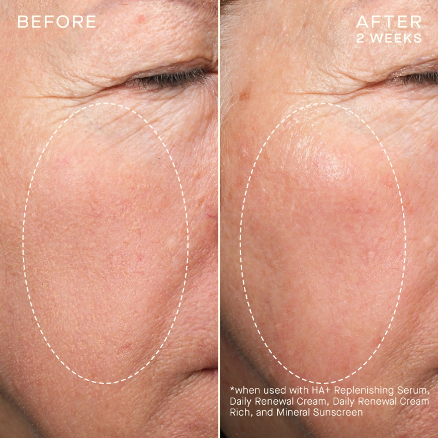 OURSELF ADVANCED REGENERATIVE SERUM