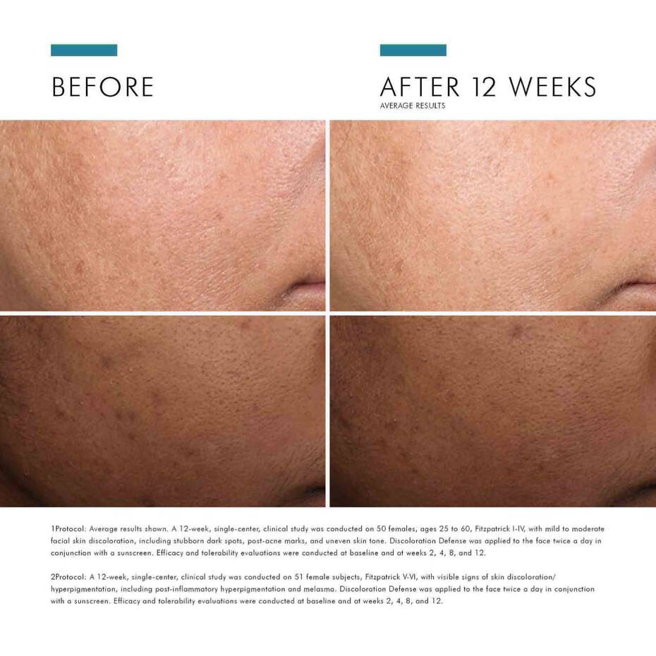 SKINCEUTICALS DISCOLORATION DEFENSE