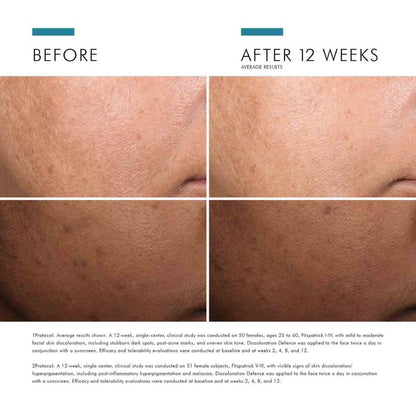 SKINCEUTICALS DISCOLORATION DEFENSE