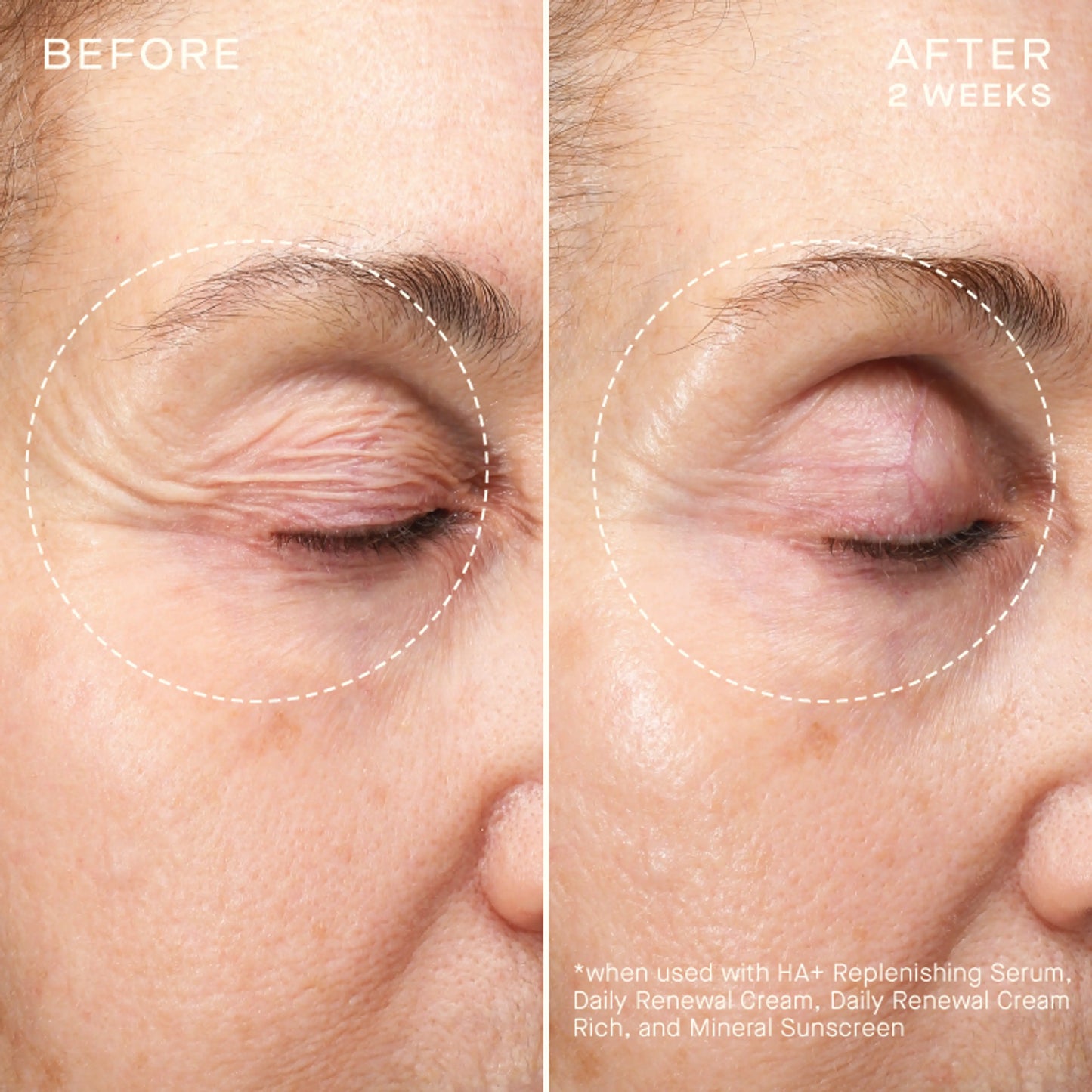 OURSELF ADVANCED REGENERATIVE SERUM