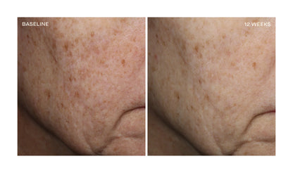 OURSELF COMPLEXION BRIGHTENING SERUM
