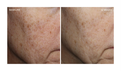 OURSELF COMPLEXION BRIGHTENING SERUM
