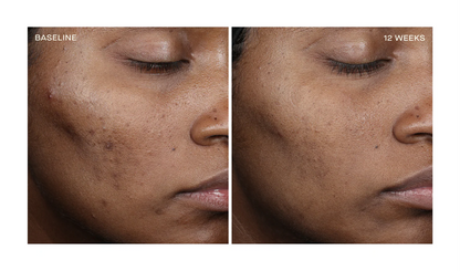 OURSELF COMPLEXION BRIGHTENING SERUM