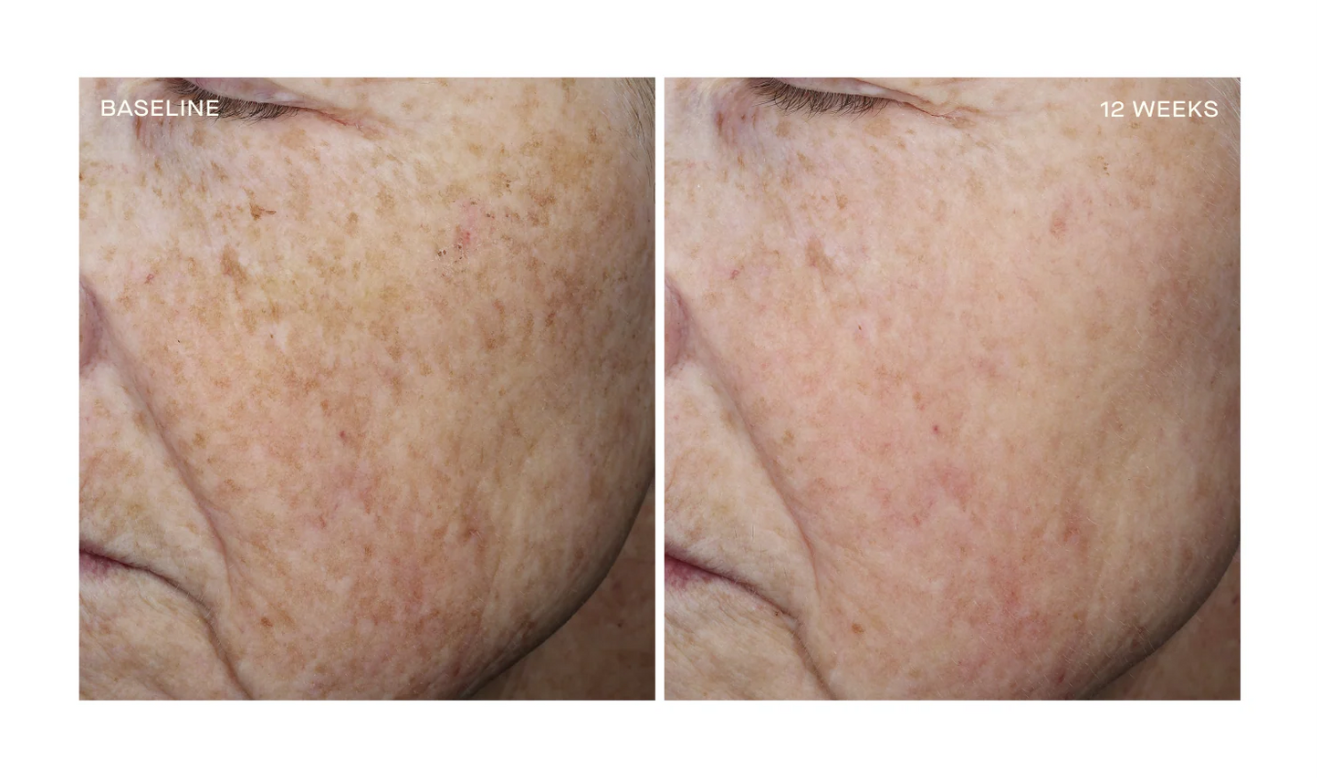 OURSELF COMPLEXION BRIGHTENING SERUM