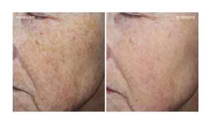 OURSELF COMPLEXION BRIGHTENING SERUM