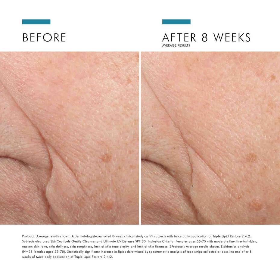 SKINCEUTICALS TRIPLE LIPID RESTORE 2:4:2