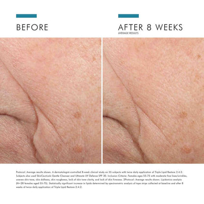 SKINCEUTICALS TRIPLE LIPID RESTORE 2:4:2